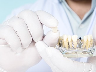 Close up of white-gloved hands holding a model jaw with a single dental implant