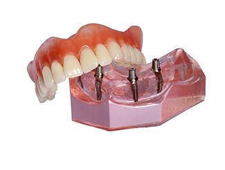 An set of implant dentures next to a base with demonstration implants